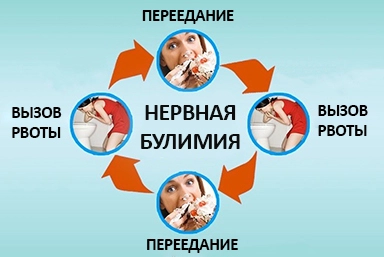 Лечение булимии в Черняховске